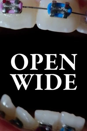 Regarder Open Wide en streaming complet